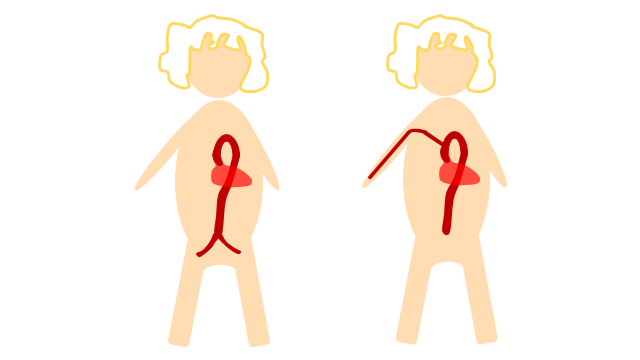 Cardiac catheterisation can be carried out by using the arteries in the arms or in the legs.